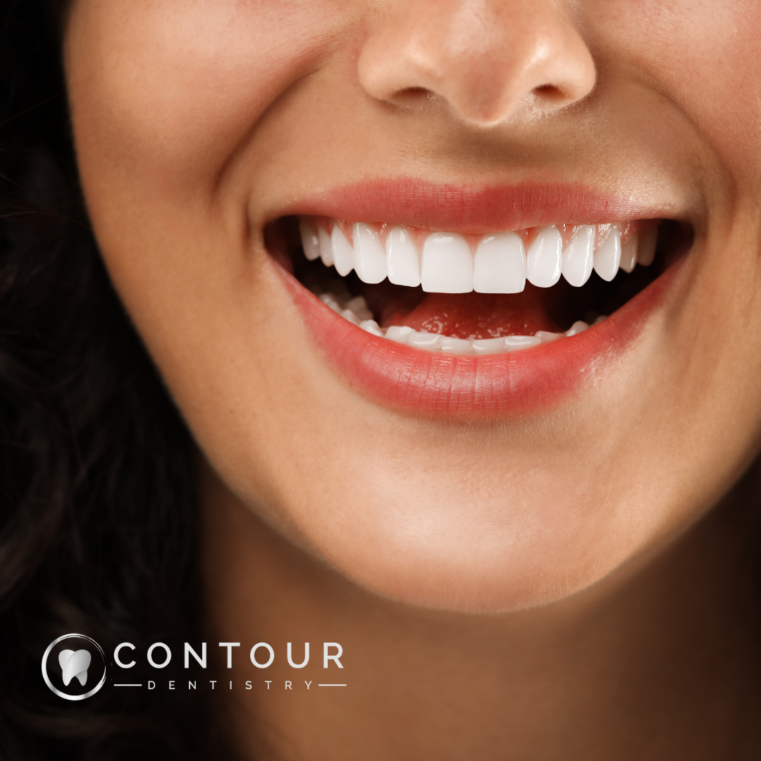 Exploring The Beauty Of Dental Veneers In Cosmetic Dentistry